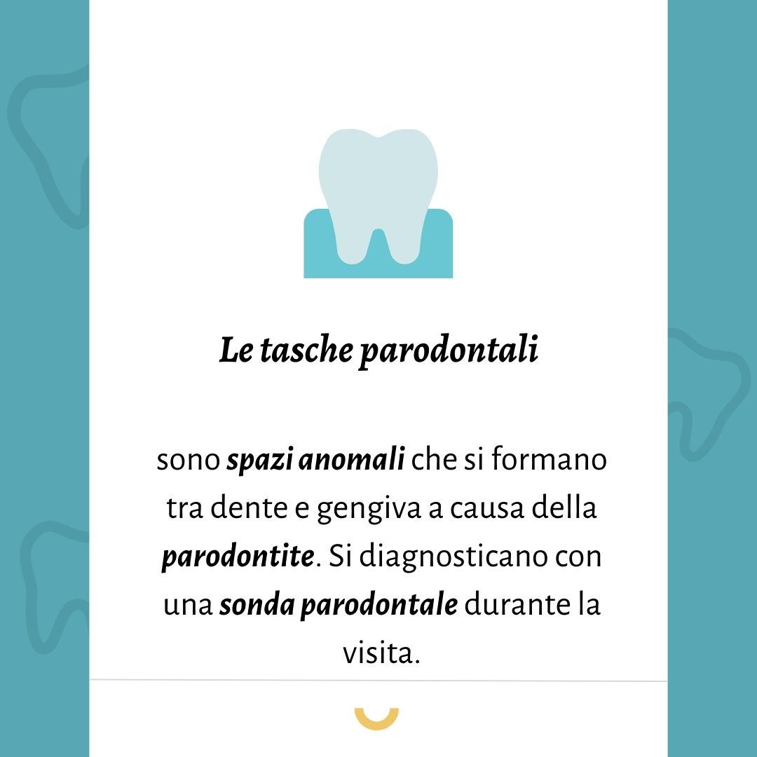 tasche parodontali cosa sono