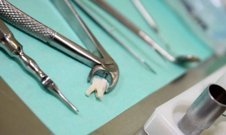 impianto dentale dopo estrazione