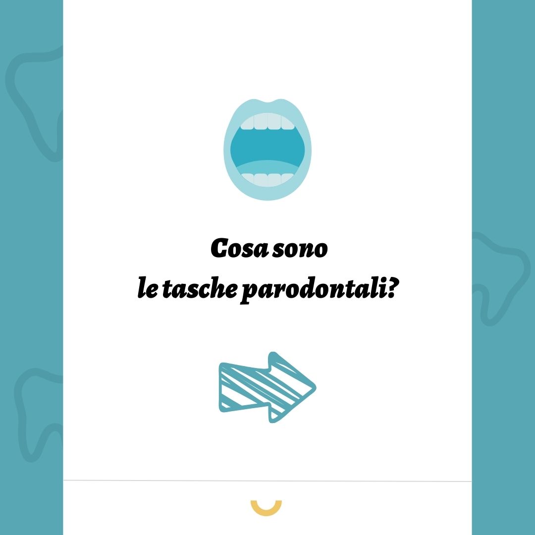 tasche gengivali