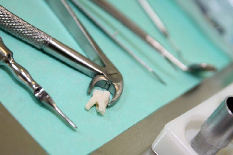 impianto dentale dopo estrazione