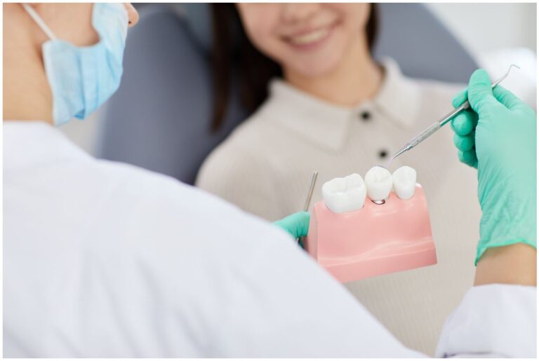cura impianti dentali