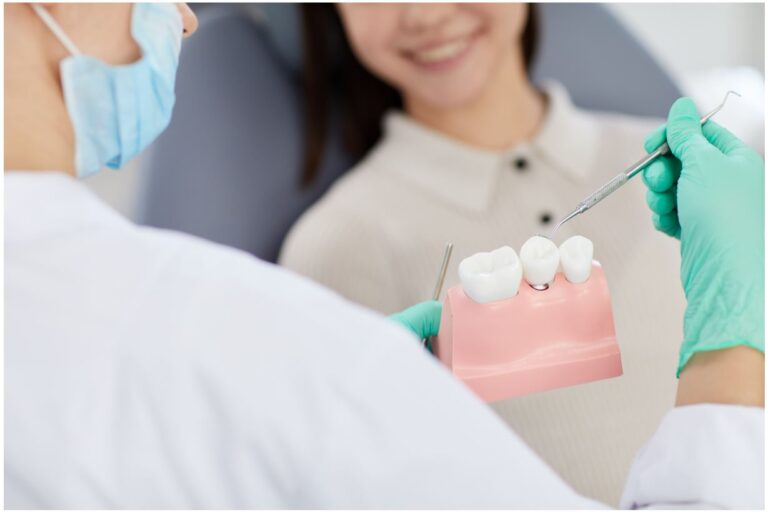 cura impianti dentali