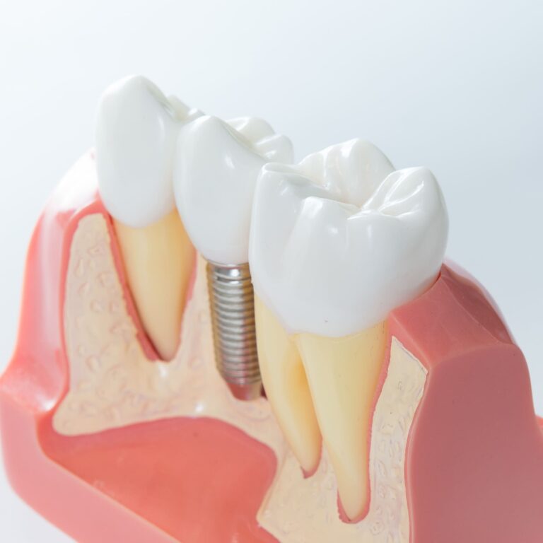 certificazione impianti dentali certificazione impianti dentali