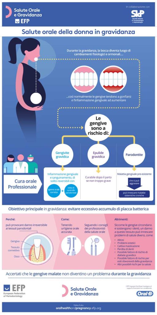 Parodontite e gravidanza