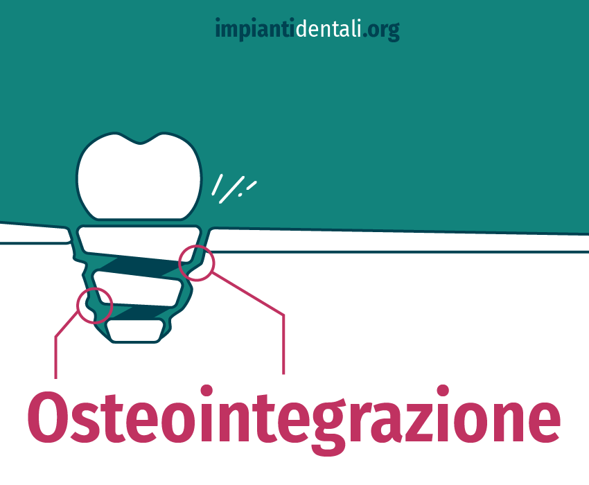 Osteointegrazione