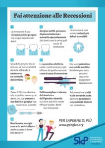 Recessione gengivale gengive ritirate Recessione gengivale gengive ritirate