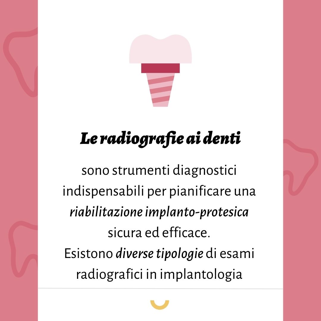 radiografia ai denti