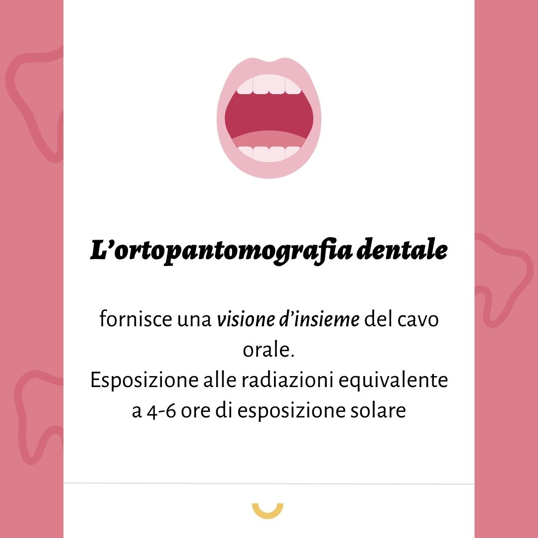 ortopantomografia dentale