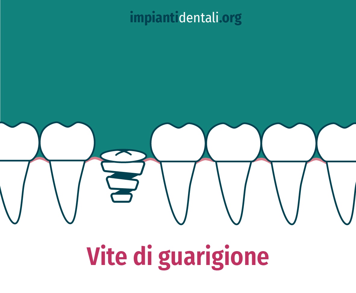 vite di guarigione vite di guarigione