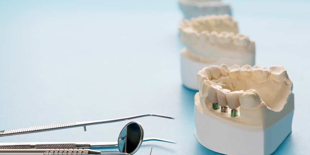 Impianto post estrattivo Impianto post estrattivo