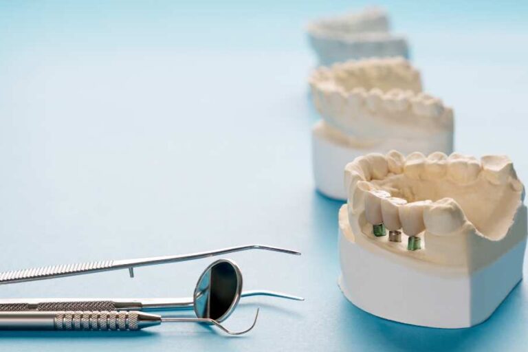 Impianto post estrattivo Impianto post estrattivo