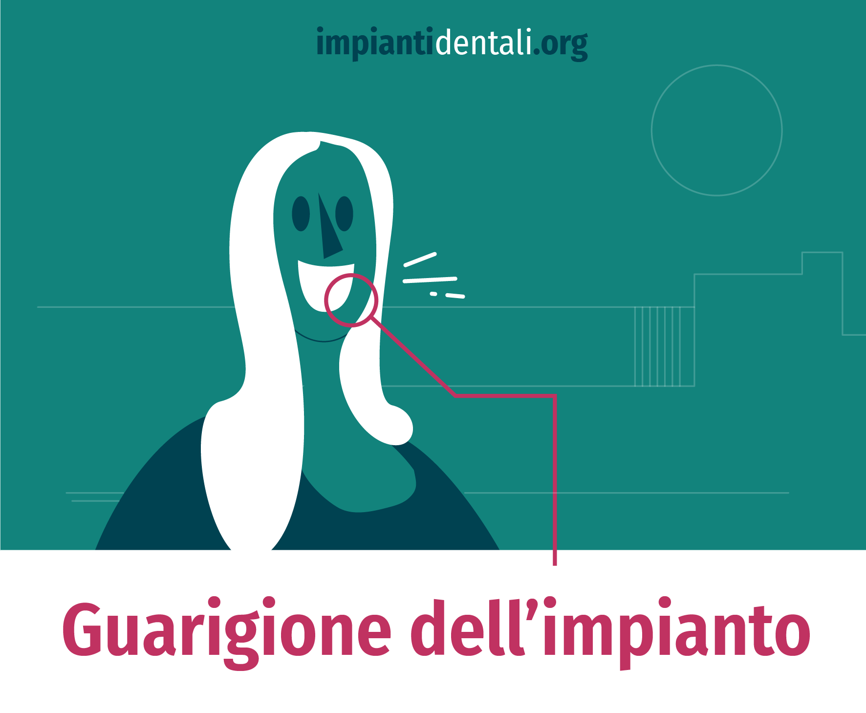 guarigione dell'impianto