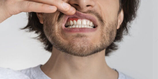 gengiva gonfia cosa fare