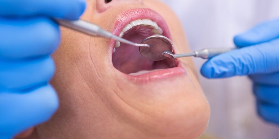parodontite recidiva