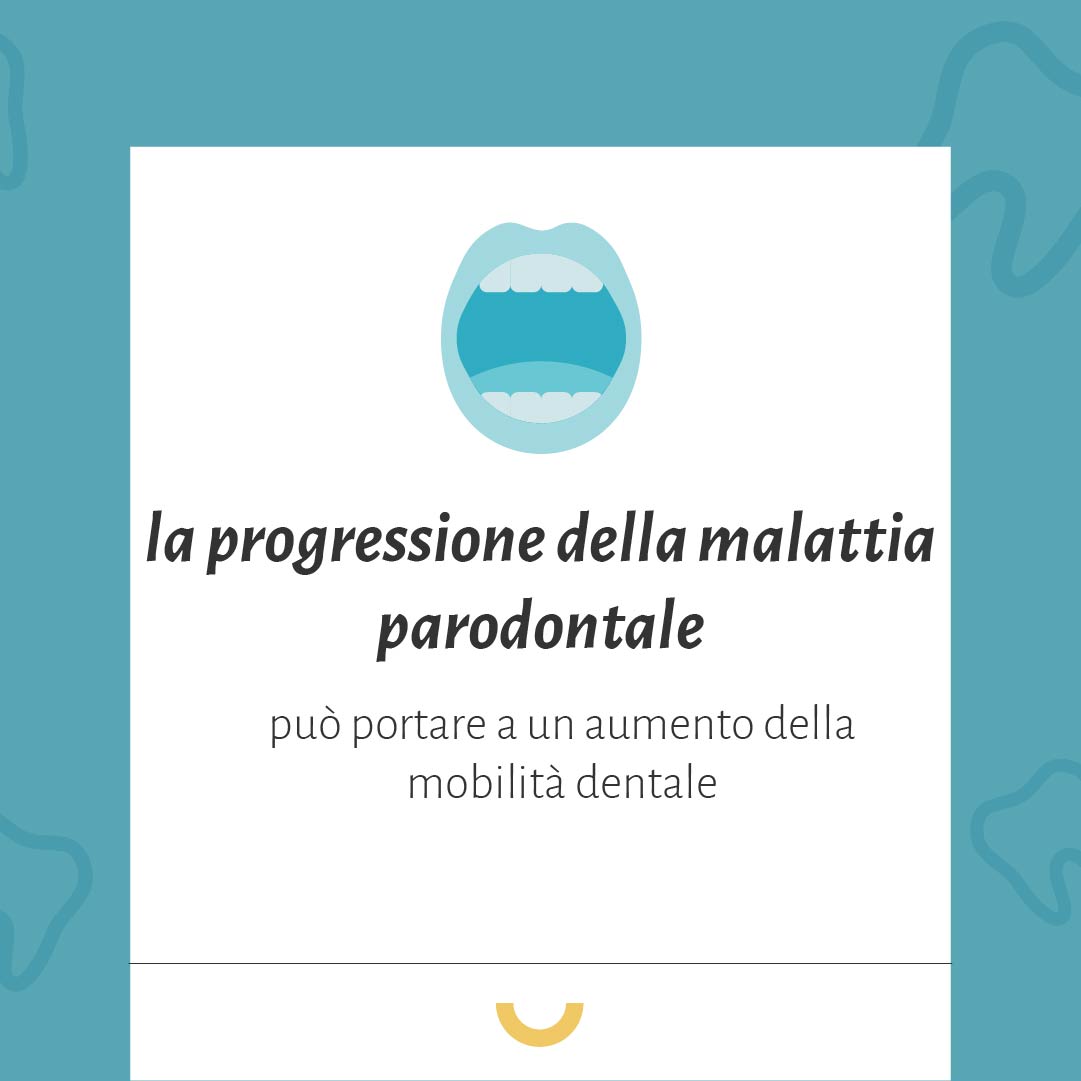 mobilità dentale