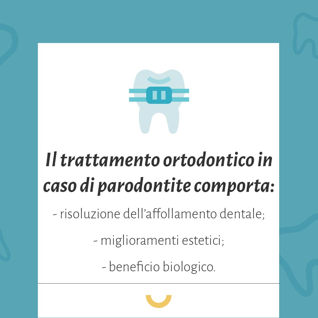 mobilità dentale