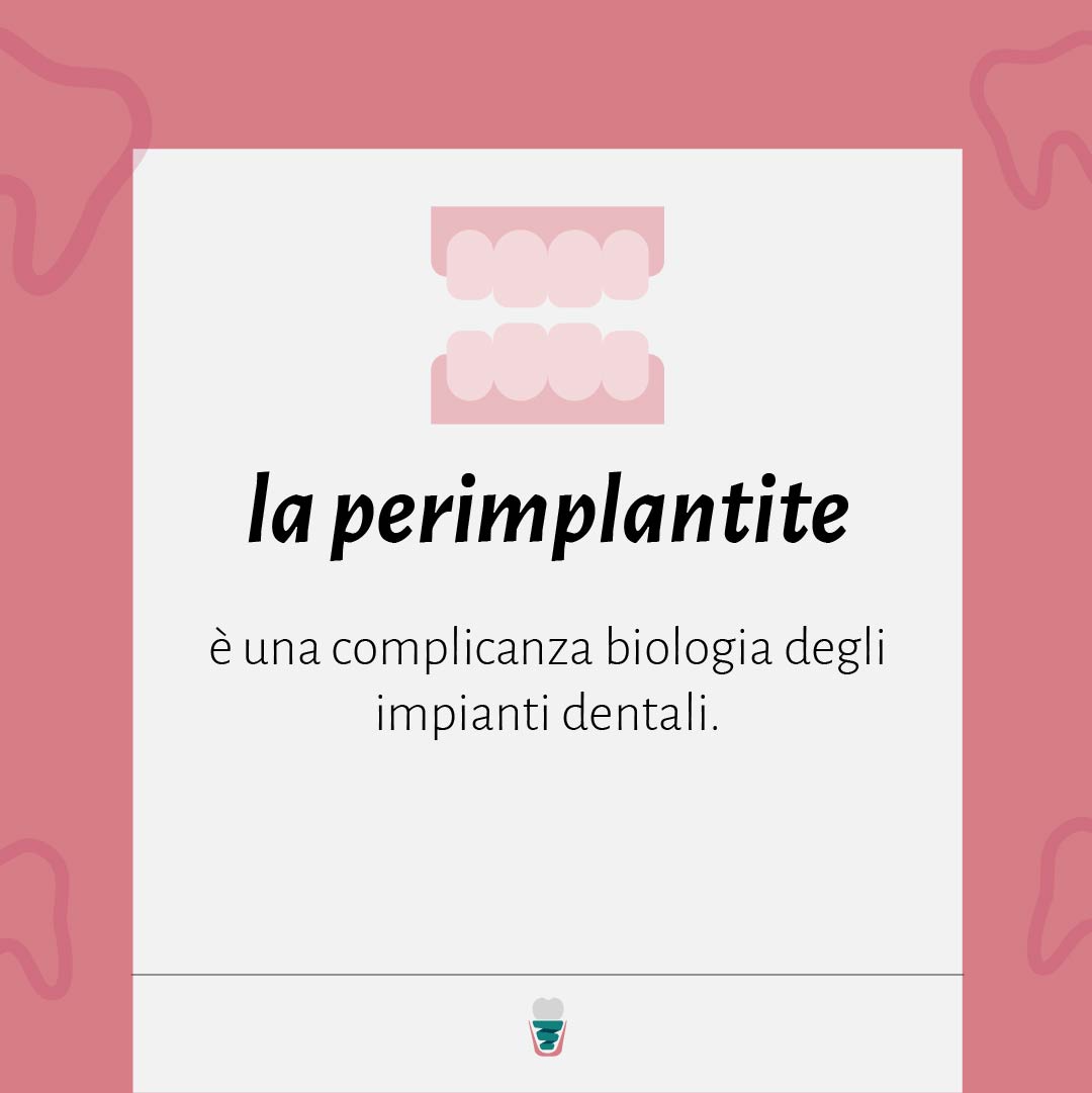 prevenire la perimplantite