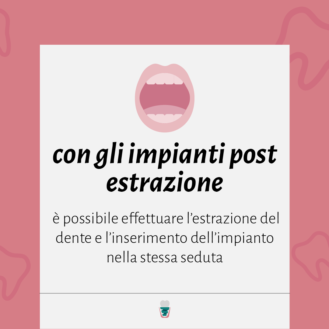 impianti post estrazione