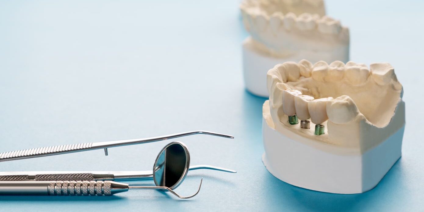 gengivite in gravidanza