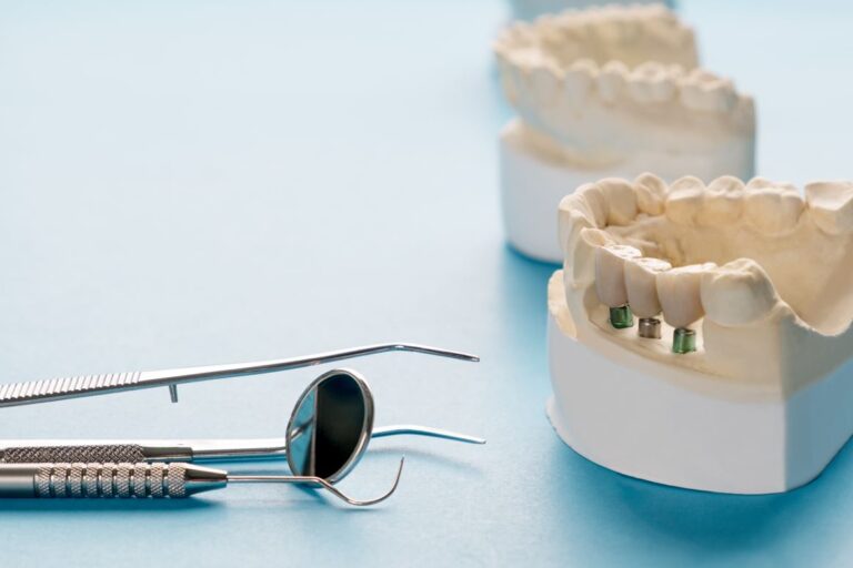 gengivite in gravidanza