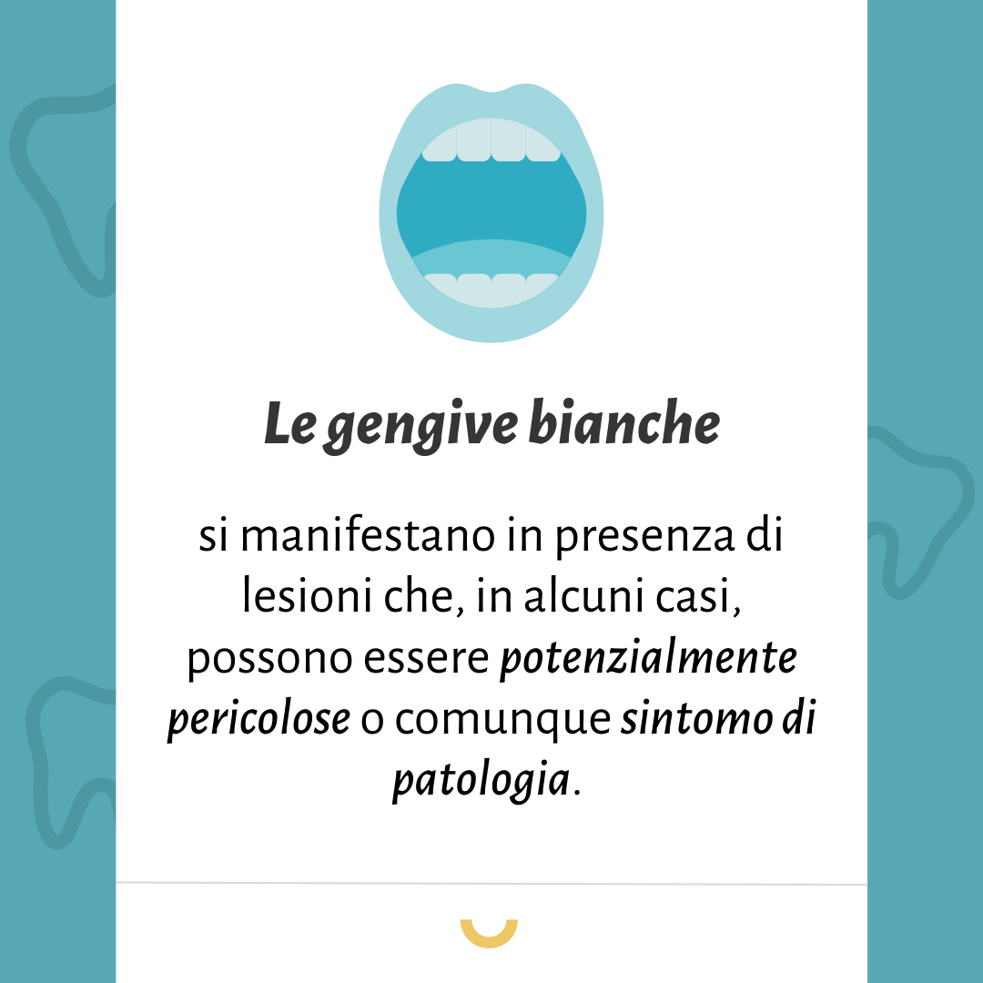 gengive bianche