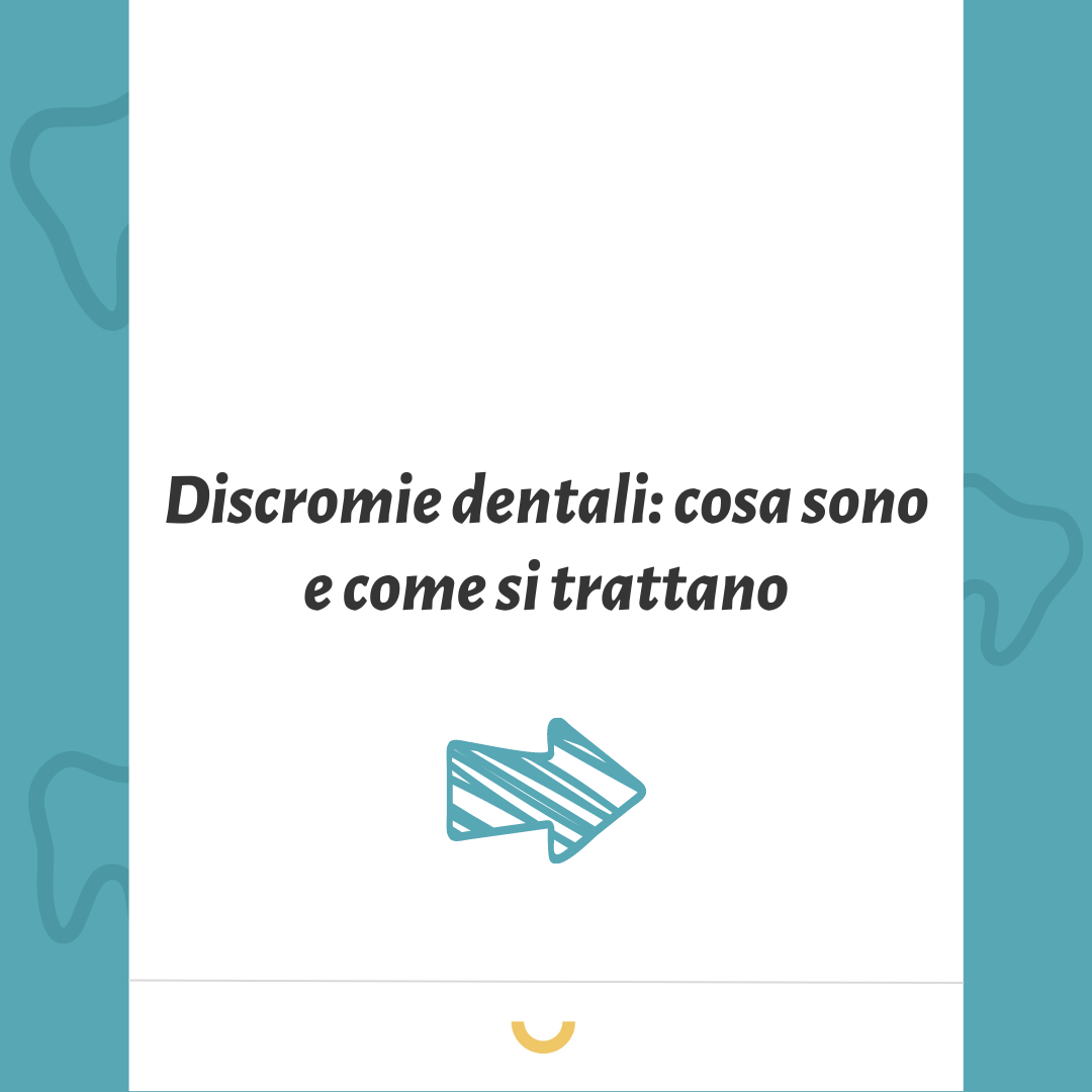 discromie dentali cosa sono