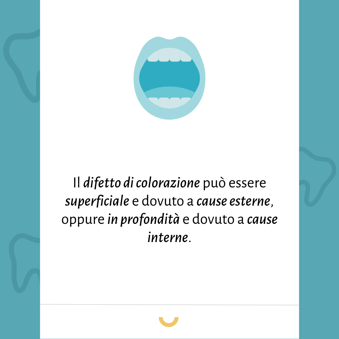 cause discromia dentale