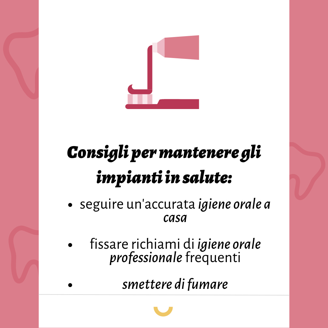 consigli impianti dentali