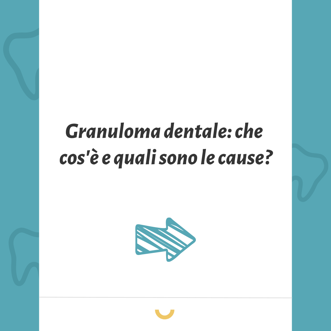 granuloma dentale