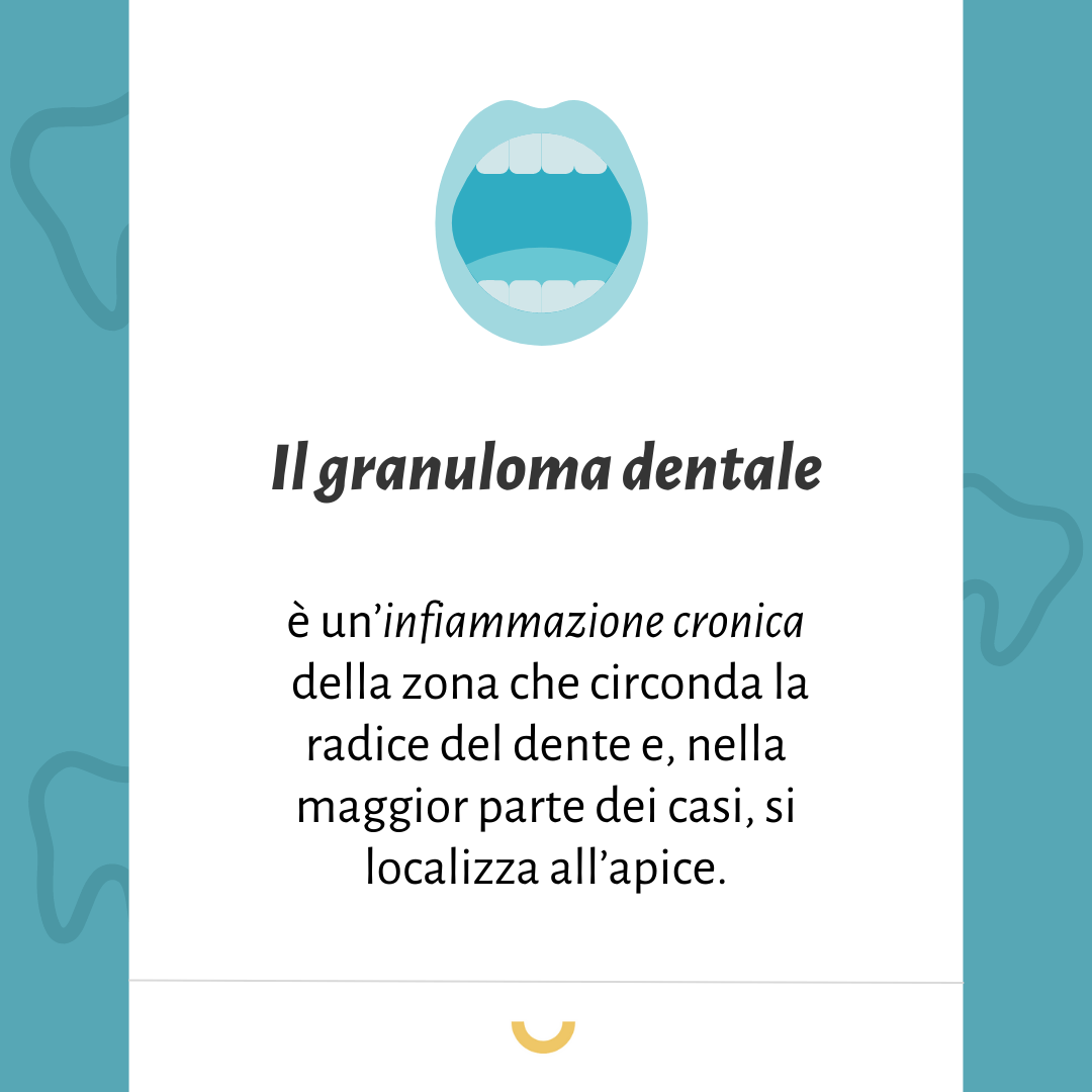 granuloma dentale sintomi