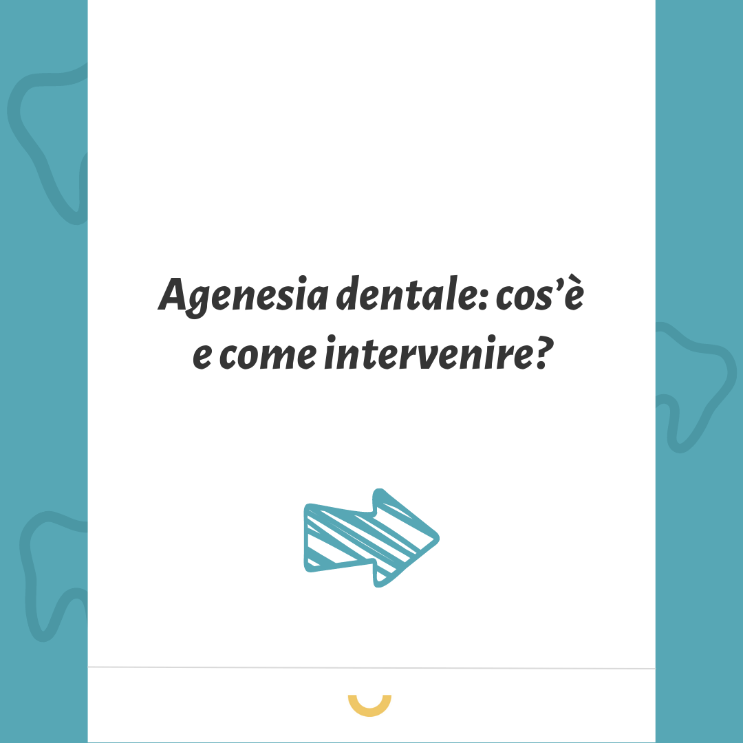 agenesia dentale