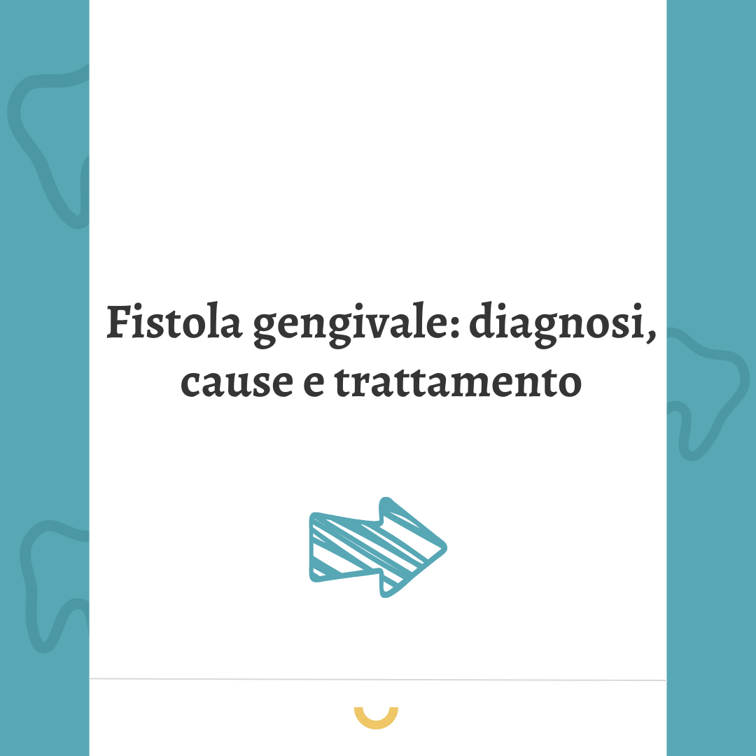 fistola gengivale