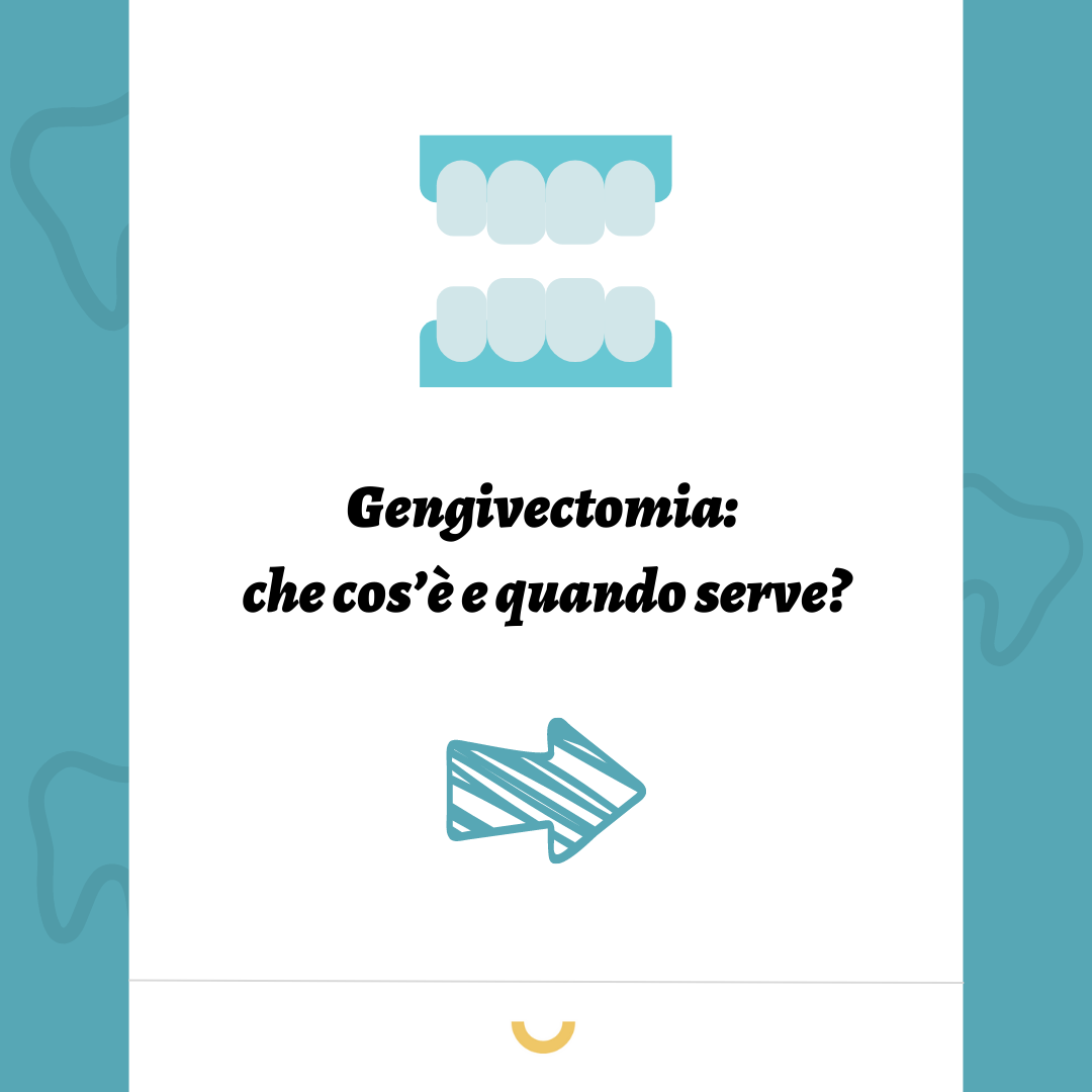 gengivectomia