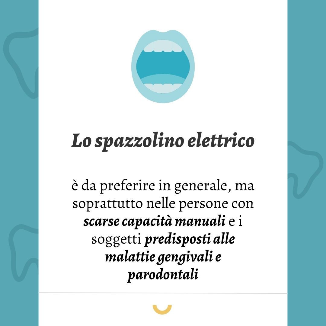 spazzolino elettrico &egrave; meglio