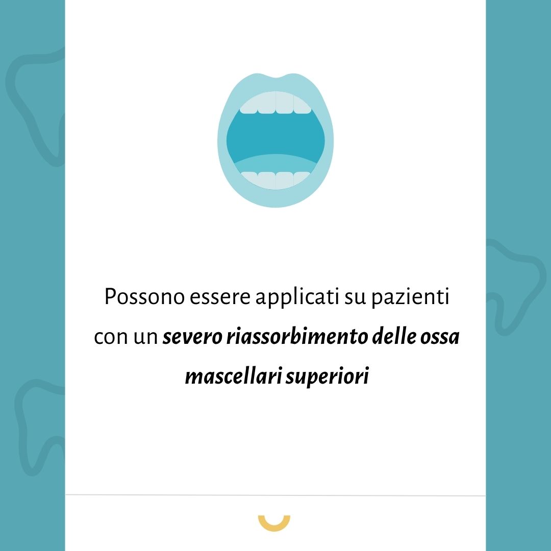 osso zigomatico