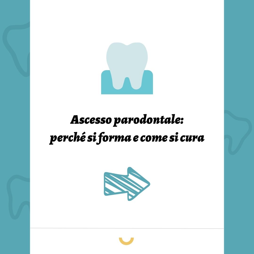 ascesso parodontale cos'è
