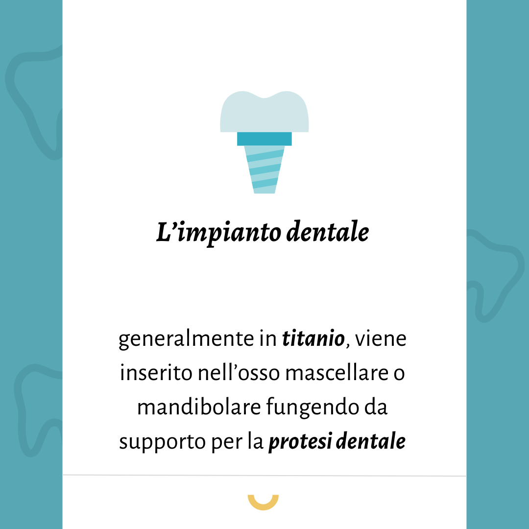 implantologia dentale