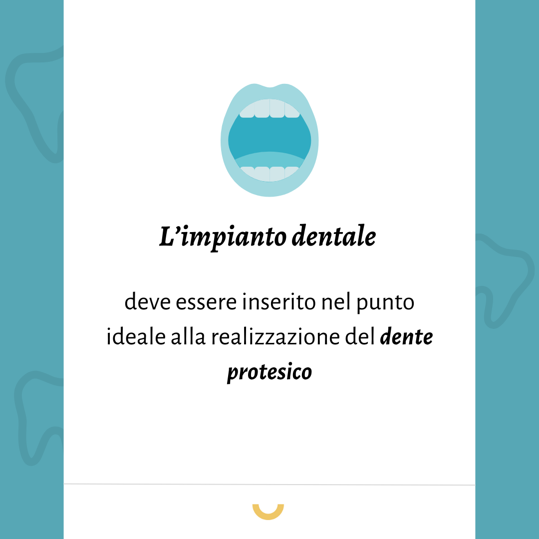 implantologia ossea dentale
