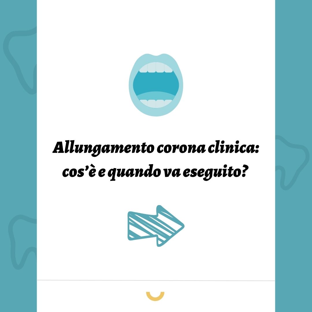 allungamento corona clinica