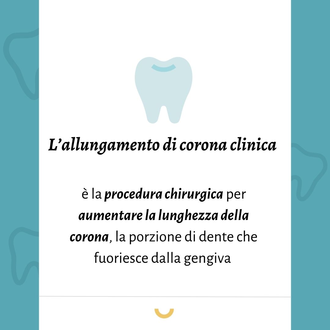 allungamento di corona clinica