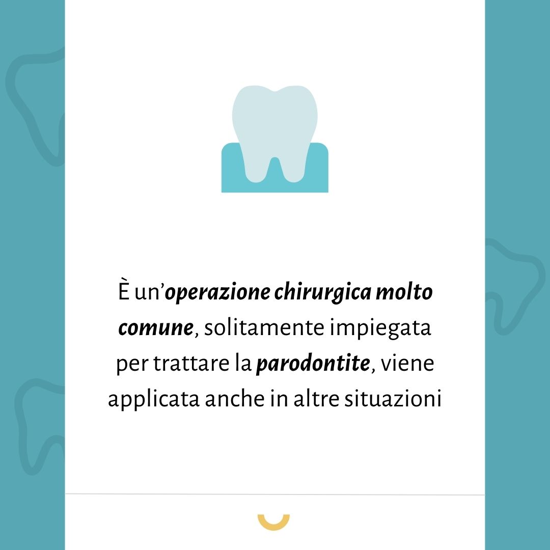 allungamento corona dentale