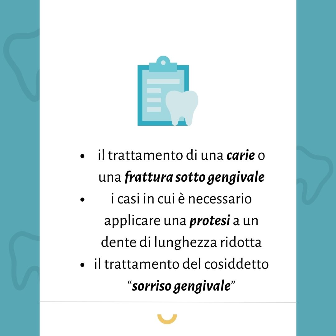 allungamento della corona clinica parodontologia