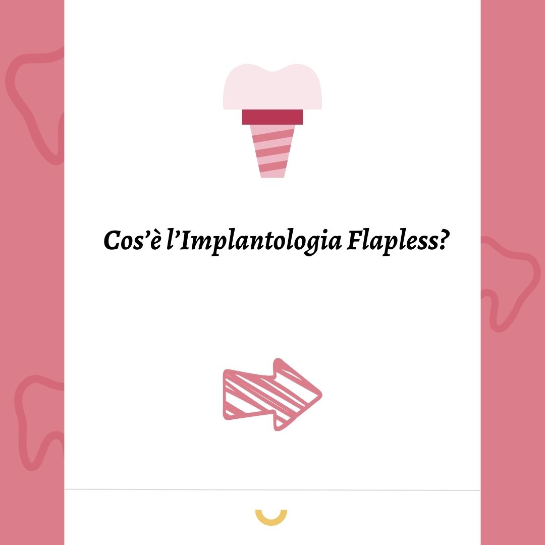 implantologia flapless
