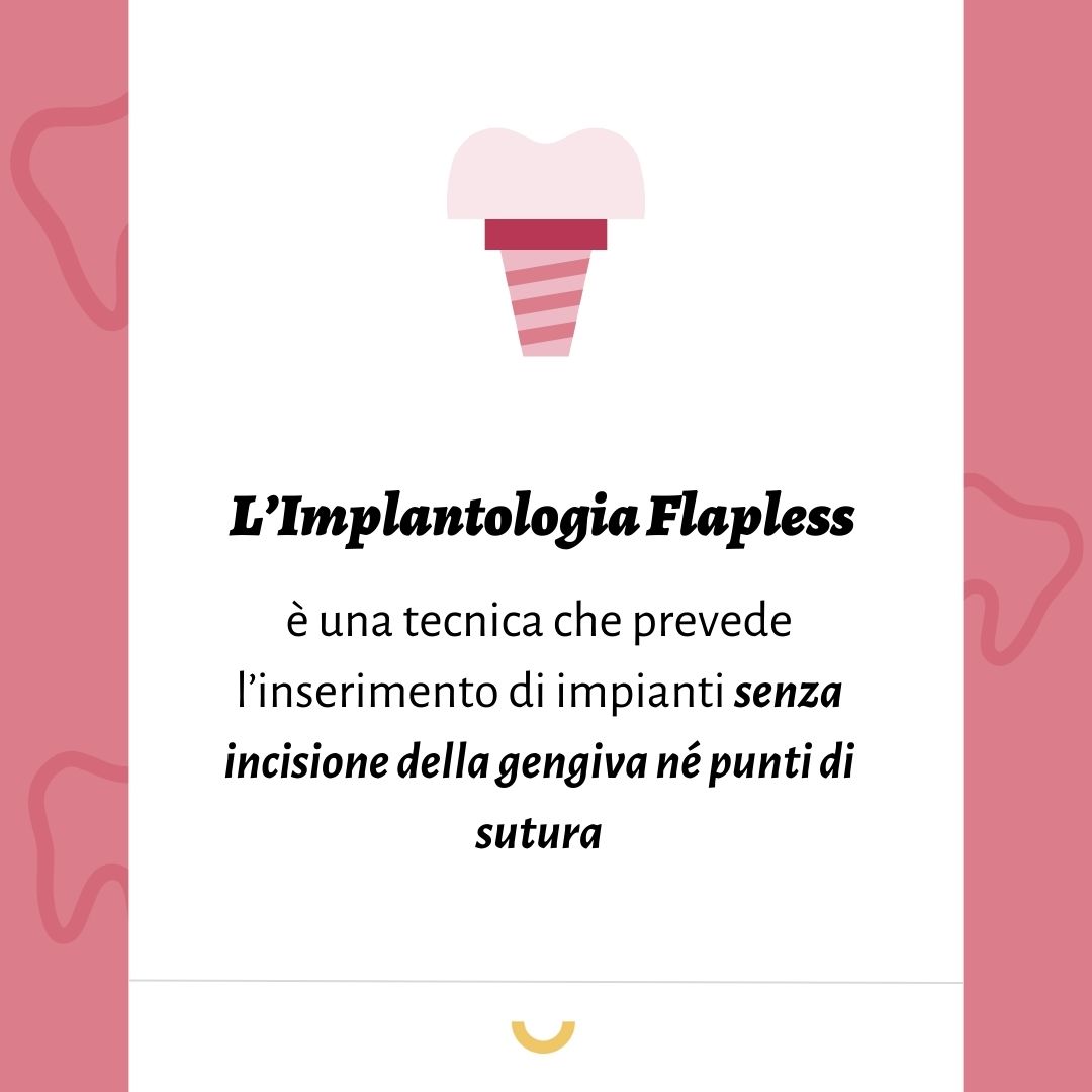 impianti flapless