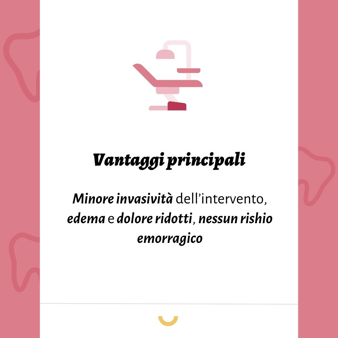 impianti flapless