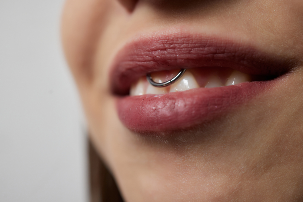piercing smiley rovina i denti