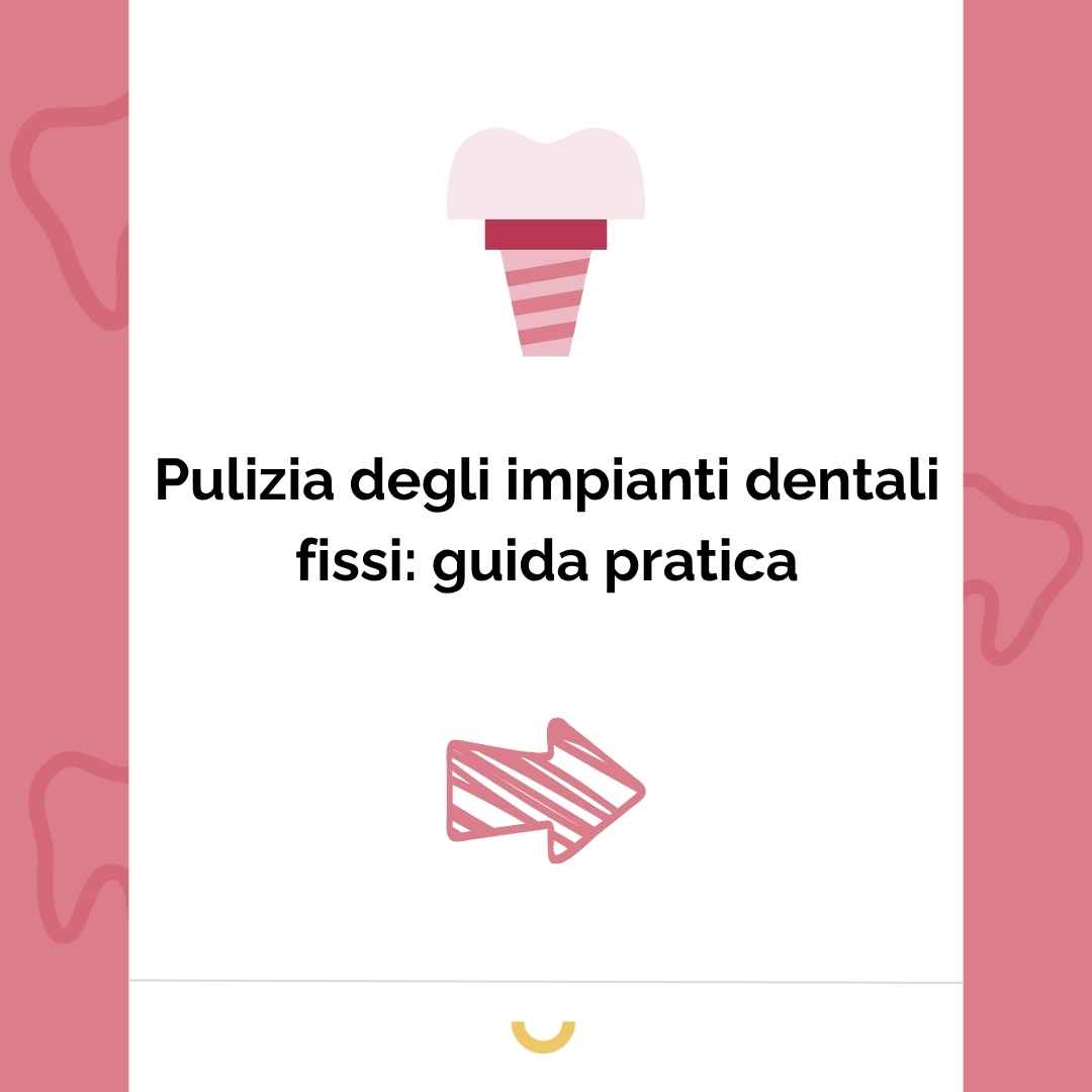 come pulire gli impianti dentali fissi
