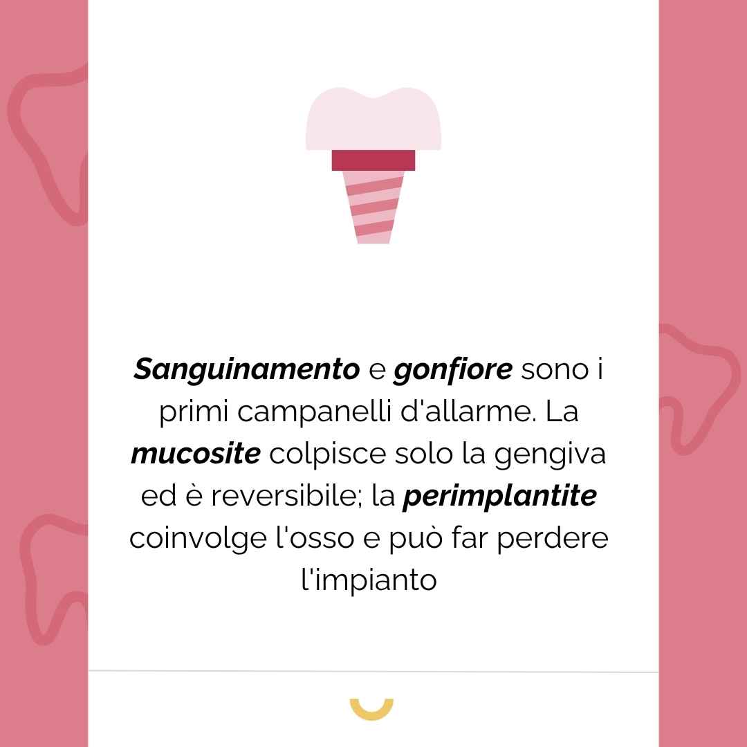 malattie impianti dentali