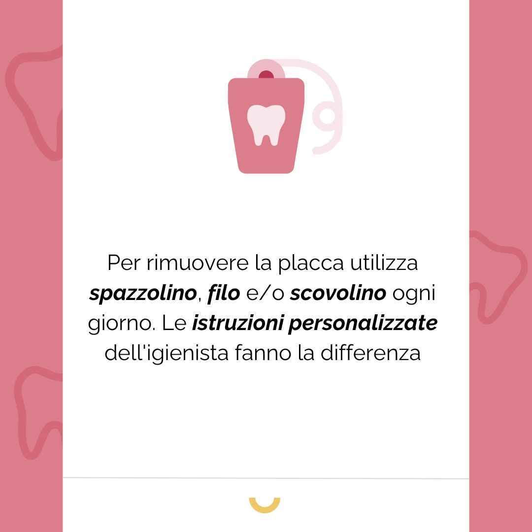 pulire impianti dentali